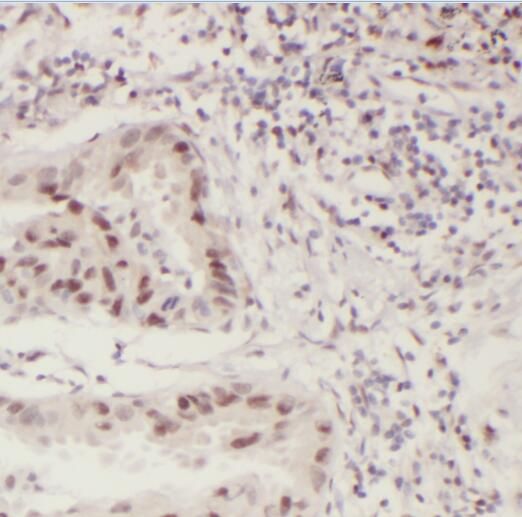 PCIF1 Antibody - BSA Free