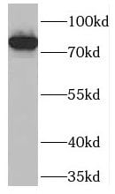 PCIF1 Antibody - BSA Free