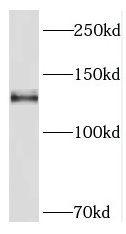 PCDH11Y Antibody - BSA Free
