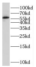 PCCB Antibody - BSA Free