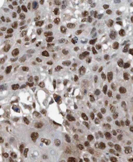 Pbx3 Antibody - BSA Free