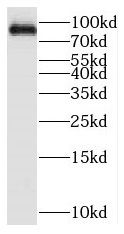 BAL/PARP9 Antibody - BSA Free
