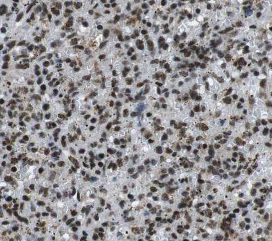 BAL/PARP9 Antibody - BSA Free