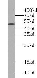 PARP15 Antibody - BSA Free