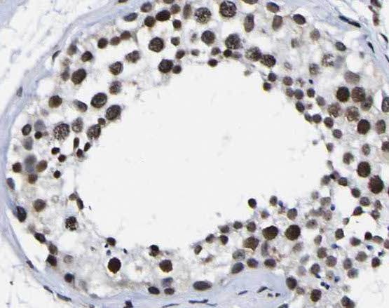 PARP11 Antibody - BSA Free