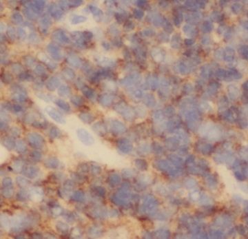 PAFAH2 Antibody - BSA Free