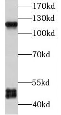 P2X5/P2RX5 Antibody - BSA Free