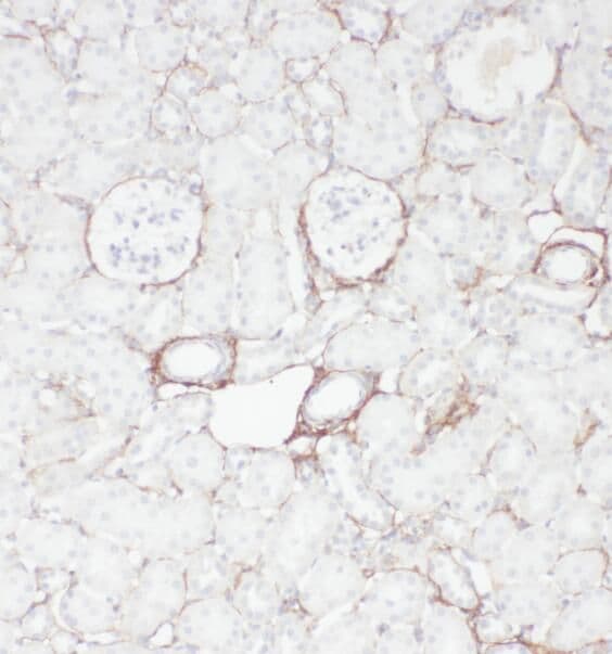 OXER1/5-oxo-ETE GPCR Antibody - BSA Free