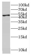 OVCA1 Antibody - BSA Free