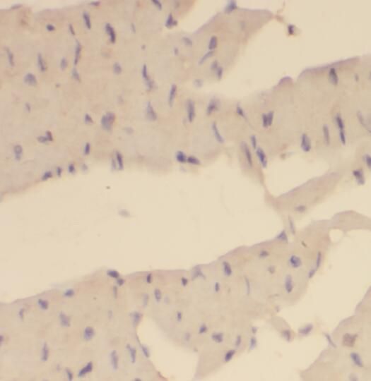 OVCA1 Antibody - BSA Free