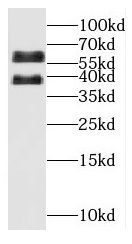OSGIN1 Antibody - BSA Free
