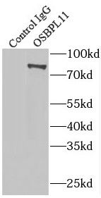 OSBPL11 Antibody - BSA Free