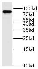 OSBPL11 Antibody - BSA Free