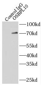 OSBPL10 Antibody - BSA Free