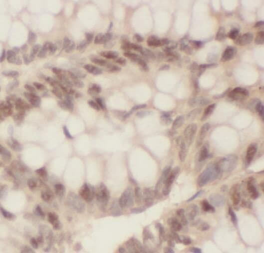 OSBPL10 Antibody - BSA Free