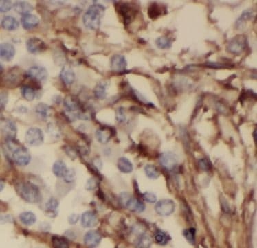 ODAM Antibody - BSA Free