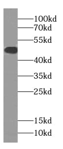 SLC22A16 Antibody - BSA Free