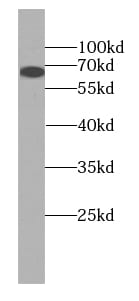 SLCO1C1 Antibody - BSA Free