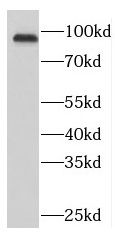 NUP93 Antibody - BSA Free