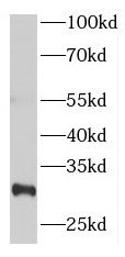NUP62CL Antibody - BSA Free