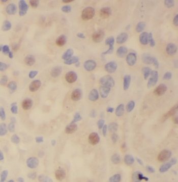 NUP205 Antibody - BSA Free