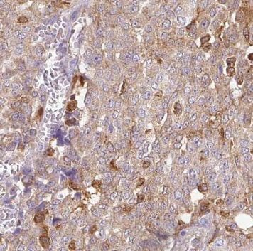NUDT11 Antibody - BSA Free