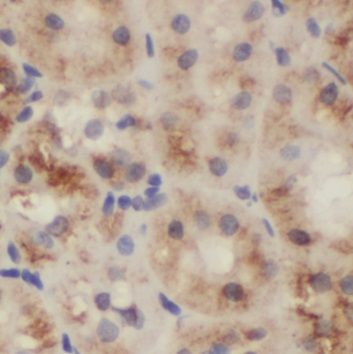 NUDCD2 Antibody - BSA Free