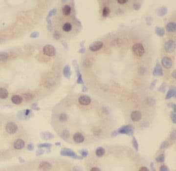 NUAK2 Antibody - BSA Free