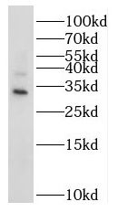 NT5C3L Antibody - BSA Free