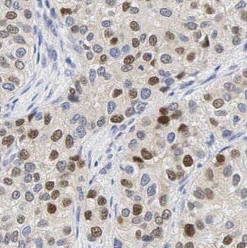 NSUN2 Antibody - BSA Free