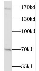 NSD3 Antibody - BSA Free