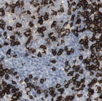 NSD3 Antibody - BSA Free