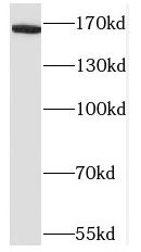 Neurexin 1 beta/NXRN1b Antibody - BSA Free