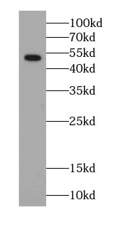 SLC17A1/NPT Antibody - BSA Free