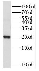 Nucleoplasmin-3 Antibody - BSA Free