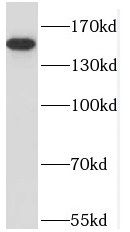 NPHP4 Antibody - BSA Free