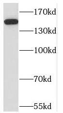NPHP3 Antibody - BSA Free