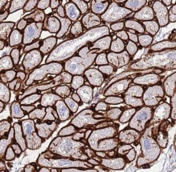 NPHP3 Antibody - BSA Free