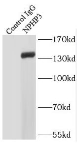 NPHP3 Antibody - BSA Free