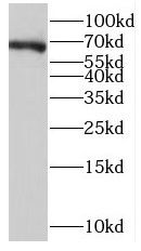 NPAS1 Antibody - BSA Free