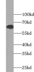 NOX5 Antibody - BSA Free