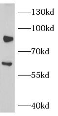 NOX5 Antibody - BSA Free