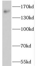 NOL8 Antibody - BSA Free