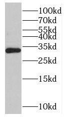 NOL12 Antibody - BSA Free