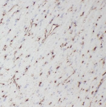 Neuromedin UR1/NMUR1 Antibody - BSA Free