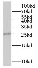 NMNAT3 Antibody - BSA Free