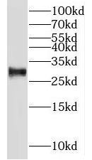NIPSNAP3B Antibody - BSA Free