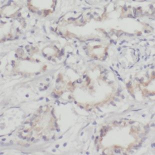 NHP2 Antibody - BSA Free