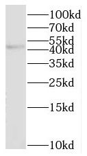 NHLRC1 Antibody - BSA Free