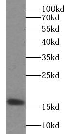 Neuroglobin Antibody - BSA Free